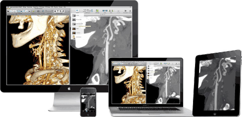 teleradiology ipad app